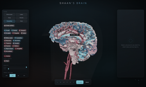 Cross-section sweeping through the brain