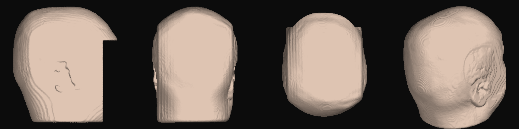 The head surface